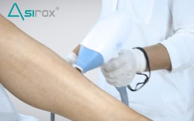 Innova en tu negocio al comprar aparatos de láser para tu estética en Valencia